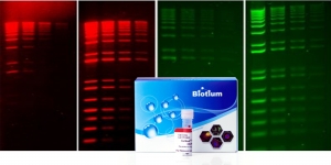Überlegene DNA-Farbstoffe für die Gel-Färbung