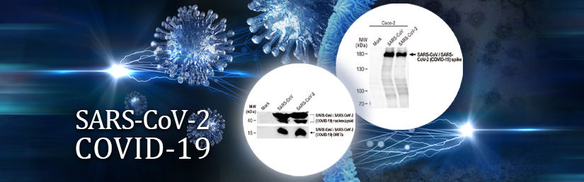 SARS-CoV-2 antibodies and proteins from GeneTex