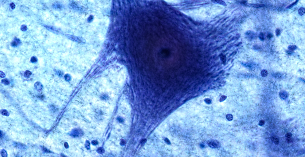 Genetex Webinar - Considerations for selecting IHC detection reagents
