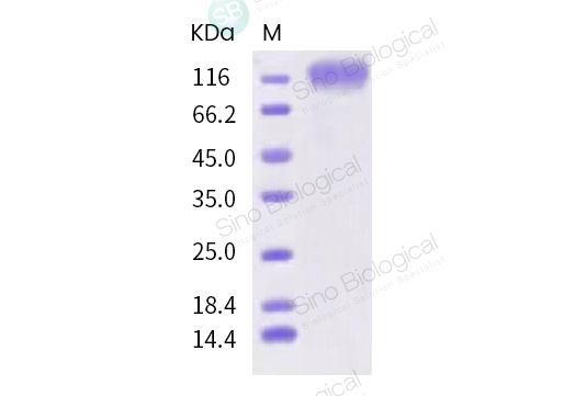 SARS-CoV-2 (2019-nCoV) Spike S1-His Recombinant Protein (HPLC 