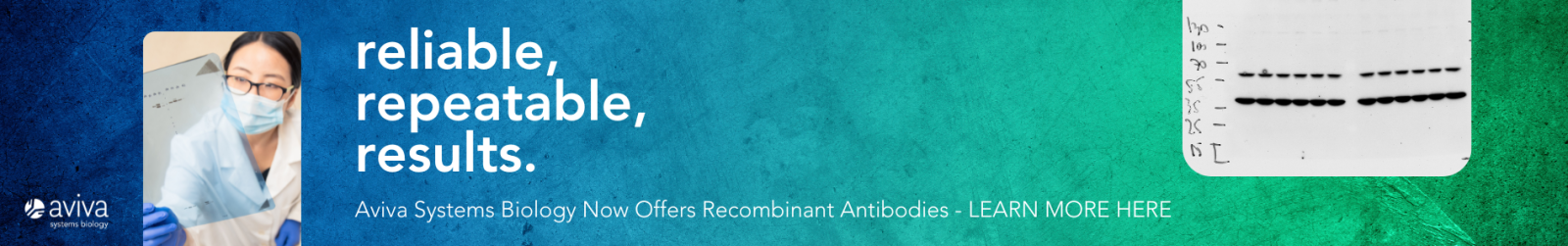 Aviva Systems Biology now offers recombinant antibodies