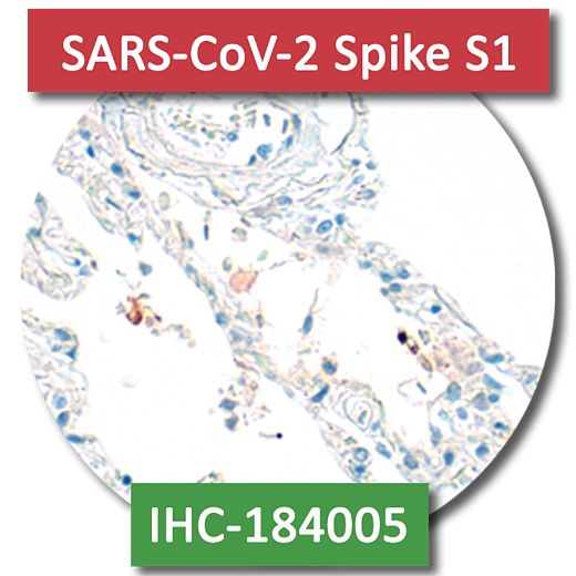 SARS-CoV-2 Spike S1 (DNA-IHC-184005)