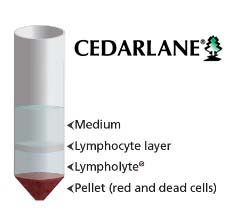 lymphocyte separation via density gradient
