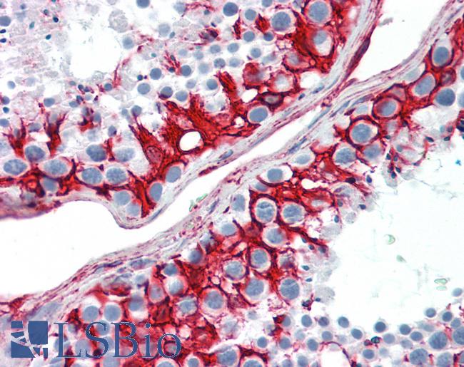 PathPlus(TM) Vimentin Antibody LS-B16168