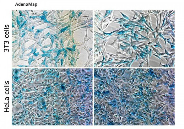 Cell transfection with AdenoMag reagent