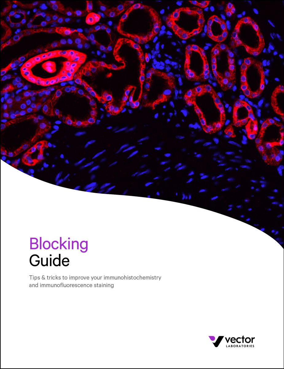 Blocking Guide