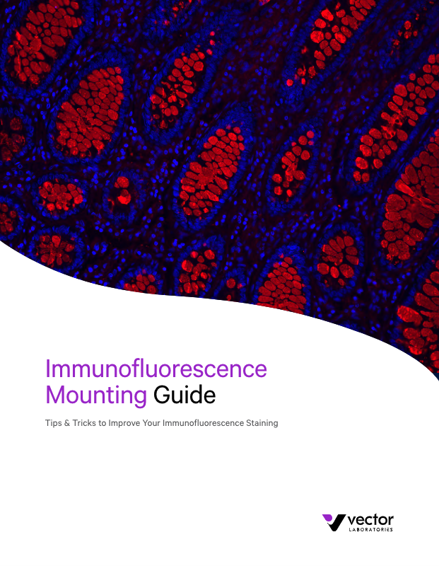 Immunofluorescence Mounting Guide