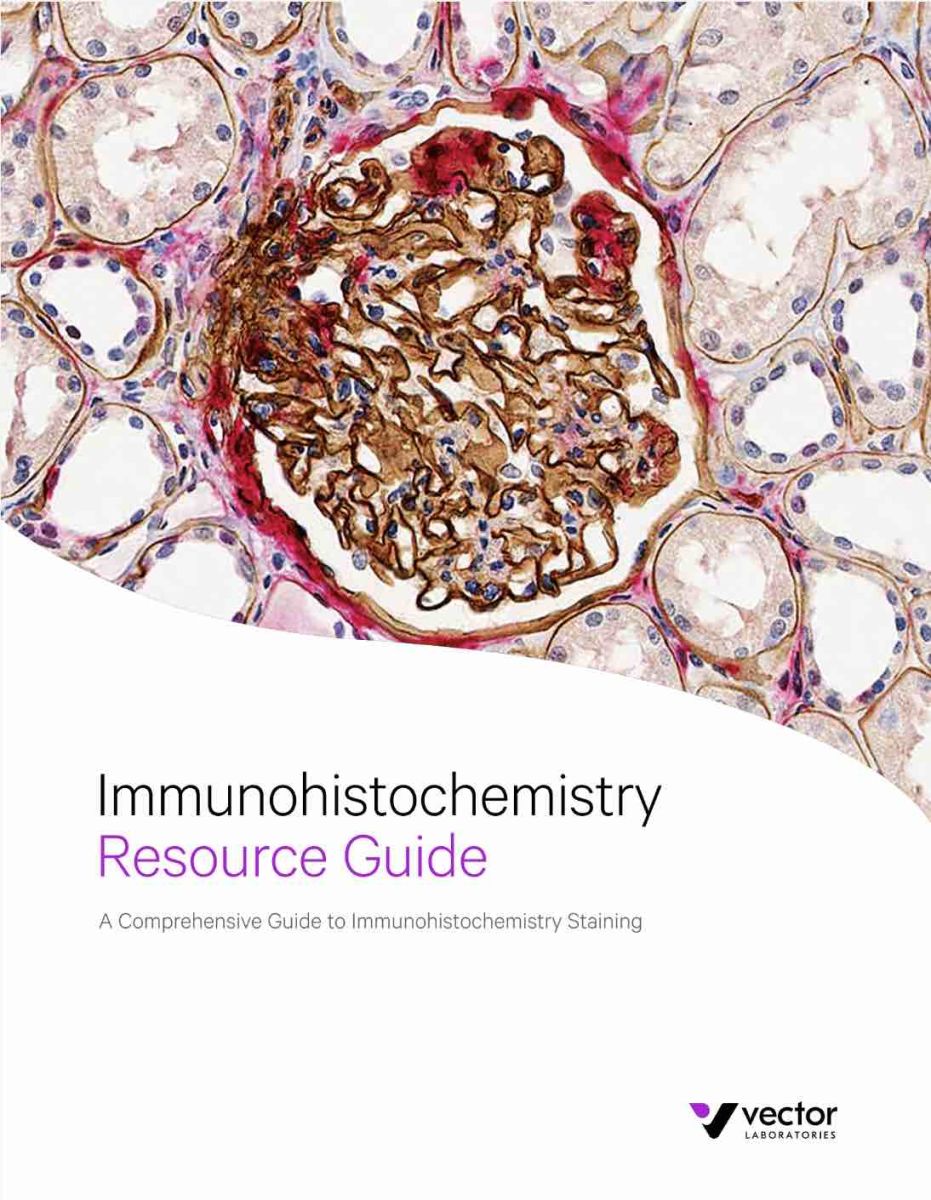 Immunohistochemistry (IHC) Resource Guide