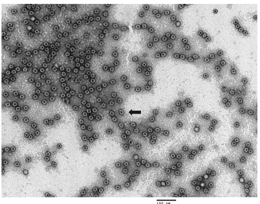 TEM purified AAV9 empty capsids